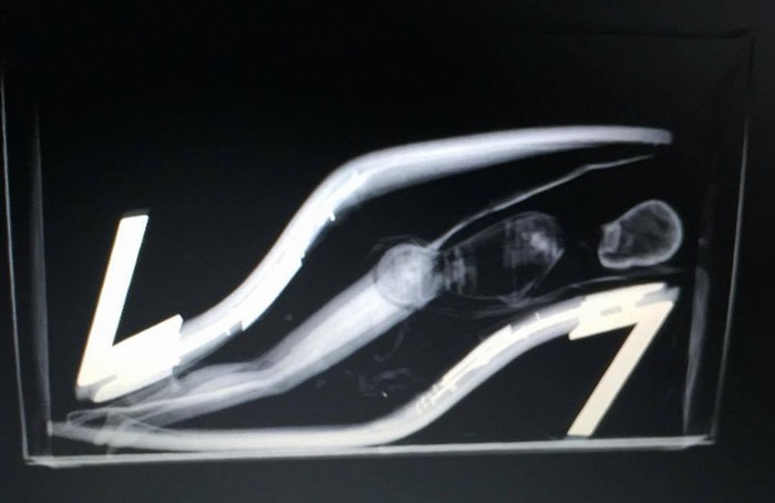 Ann_Demeulemeester_Barbi_Fetish_Cinderella_Syndrome_Fashion_Design_Shoe_Blog_Uncoded_Steps_שלי_לואיס_עיצוב